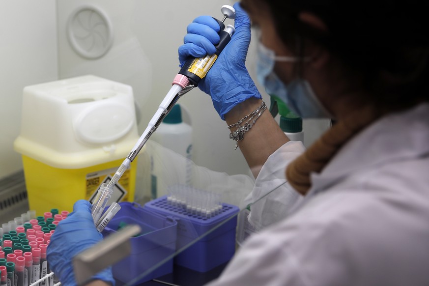 Seminar Kibir, health lab technician prepares chemicals to process analysis of some nasal swab samples to test for COVID-19 at the Hospital of Argenteuil, north of Paris, Friday Sept. 25, 2020. France ...
