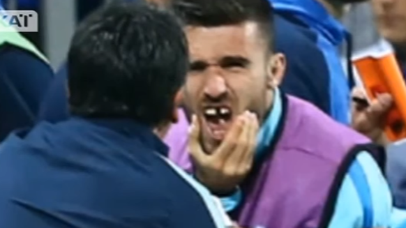 Gianniotas zeigt seine Zahnlücke.