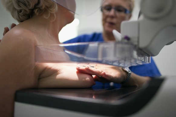 A radiographer places a woman&#039;s breast on the x-ray unit at the Clinic Engeried in Bern, Switzerland, pictured on December 8, 2009. Mammography is a method for early detection of breast cancer (b ...
