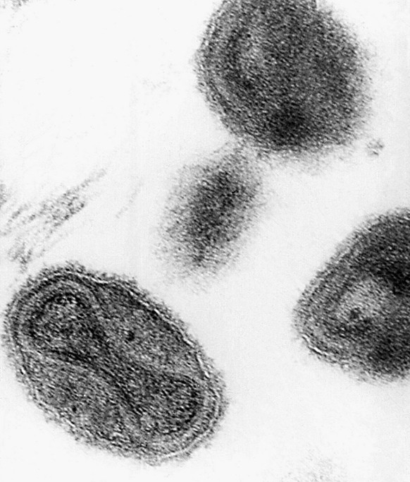 The smallpox virus is shown in this 1975 electronmicrograph from the Centers for Disease Control. Computer simulations in 2002 are helping epidemiologists plan for a potential bioterrorist attack usin ...