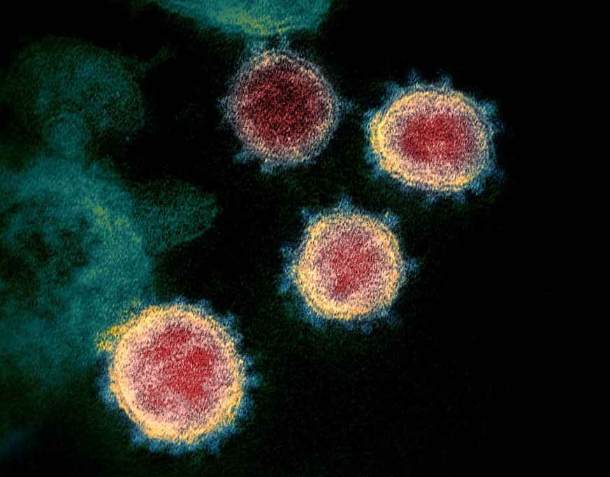This transmission electron microscope image shows SARS-CoV-2—also known as 2019-nCoV, the virus that causes COVID-19—isolated from a patient in the U.S. Virus particles are shown emerging from the sur ...