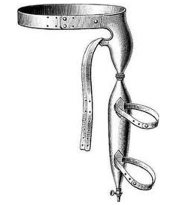 Ein eher harmloses Exemplar aus dem Jahr 1876: Damit wurde der Penis zwischen den Beinen festgebunden.