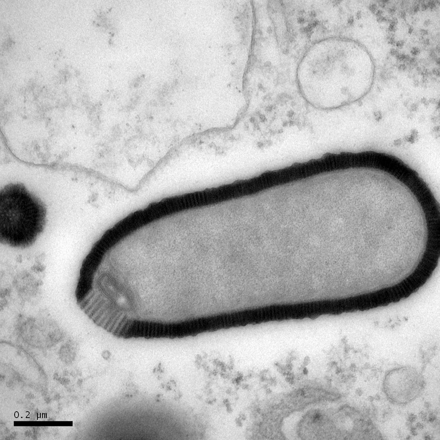 Pithovirus in einer infizierten Acanthamoeba castellanii.&nbsp;