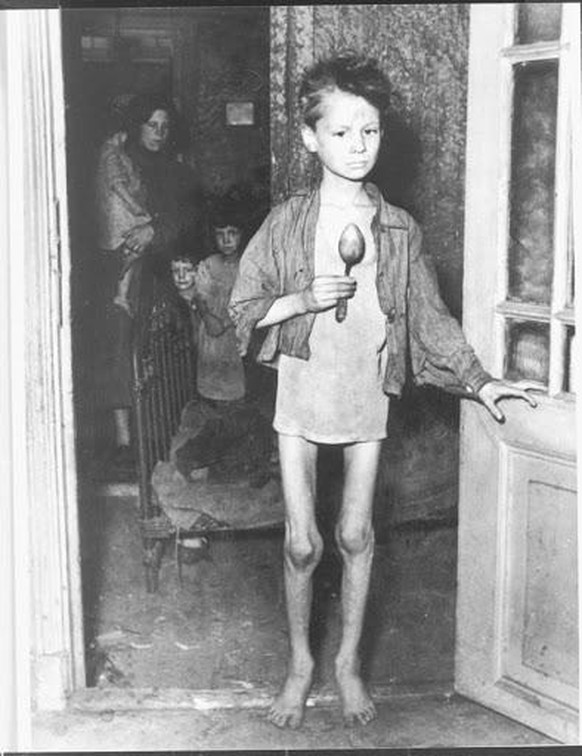 Hungerwinter in den Niederlanden. Der Junge auf dem bild überlebte. 
https://www.verzetsmuseum.org/jongeren/hongerwinter/hongerwinter,ondervoeding