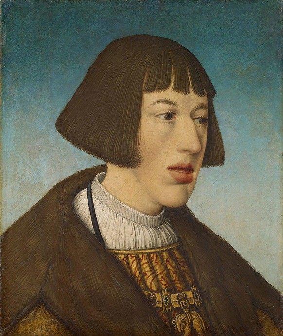 Ferdinand (1503–1564) als junger Erzherzog von Österreich mit der unverkennbaren Habsburger Unterlippe – eine durch Inzest wacker durch die Jahrhunderte vererbte Kieferfehlstellung.