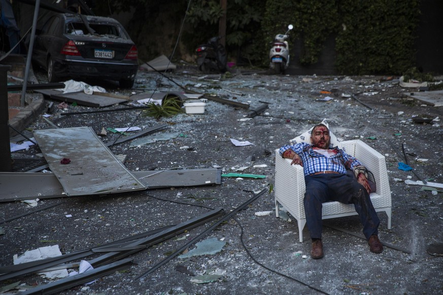 BEIRUT, LEBANON - AUGUST 04: (EDITORS NOTE: Image contains graphic content.) An injured man rests in a chair after a large explosion on August 4, 2020 in Beirut, Lebanon. Video shared on social media  ...