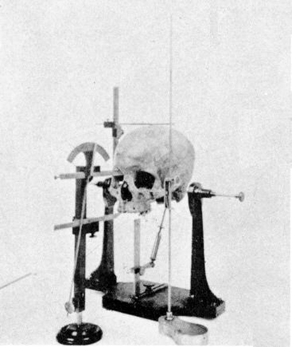 historisches Kraniometer, Kraniometrie, Schädelvermessung
https://de.wikipedia.org/wiki/Kraniometrie#/media/Datei:Craniometry_skull_1902.jpg