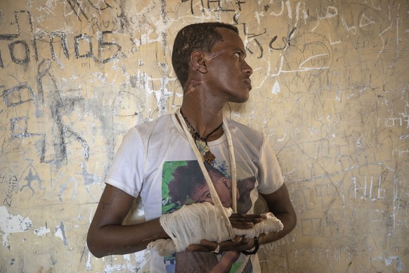 FILE - In this Tuesday, Dec. 15, 2020 file photo, ethnic Tigrayan survivor Abrahaley Minasbo, 22, from Mai-Kadra, Ethiopia, shows his wounds from machetes, inside a shelter, in Hamdeyat Transition Cen ...