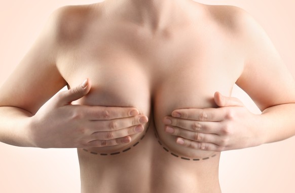 Brust operation silikon