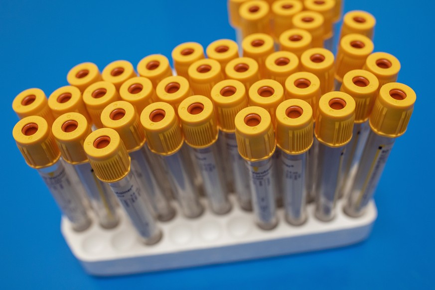 epa08466913 Test tubes to be used for blood samples sit on table at a antibody testing program at the Hollymore Ambulance Hub of the West Midlands Ambulance Service, operated by the West Midlands Ambu ...