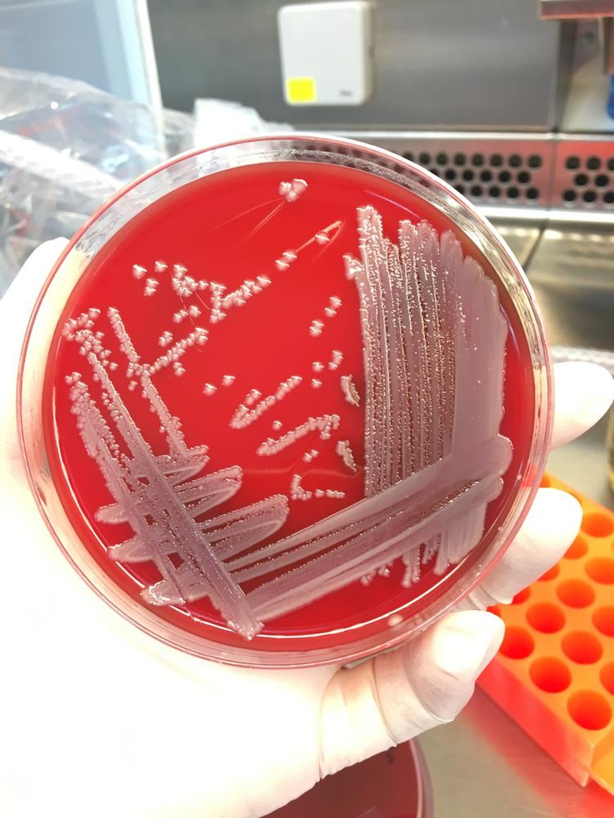 pathogene Bakterien auf Blutagar