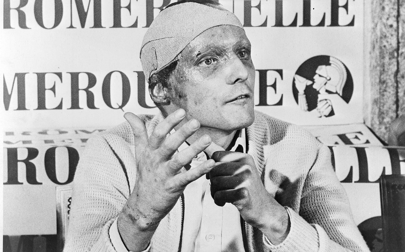 Austrian auto racer Niki Lauda, following his near fatal crash at the West German Grand Prix six weeks ago, announced he would start at the Italian Grand Prix at Monza, Sept. 12. (AP Photo) (KEYSTONE/ ...