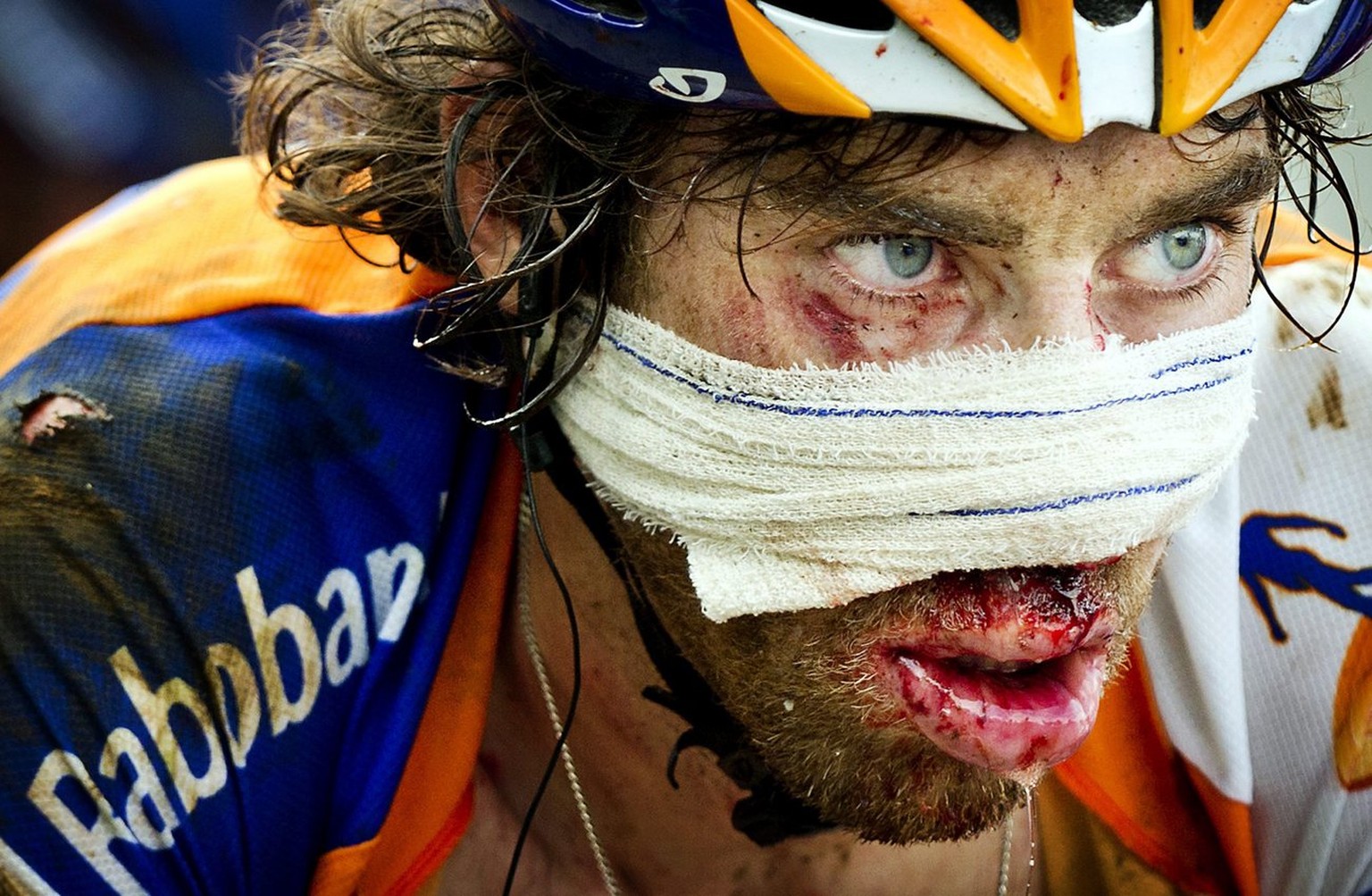 A photograph made available on 17 July of Dutch Rabo rider Laurens ten Dam is covered with blood after he crashed on the descent of the Col d&#039;Agnes during the fourteenth stage of the Tour de Fran ...