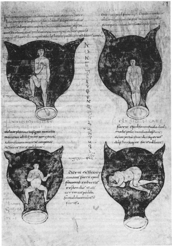 Soranos' Gynäkologie in einer spätantiken lateinischen Bearbeitung, um 900: Darstellungen von Kindslagen; Embryonen im Uterus.