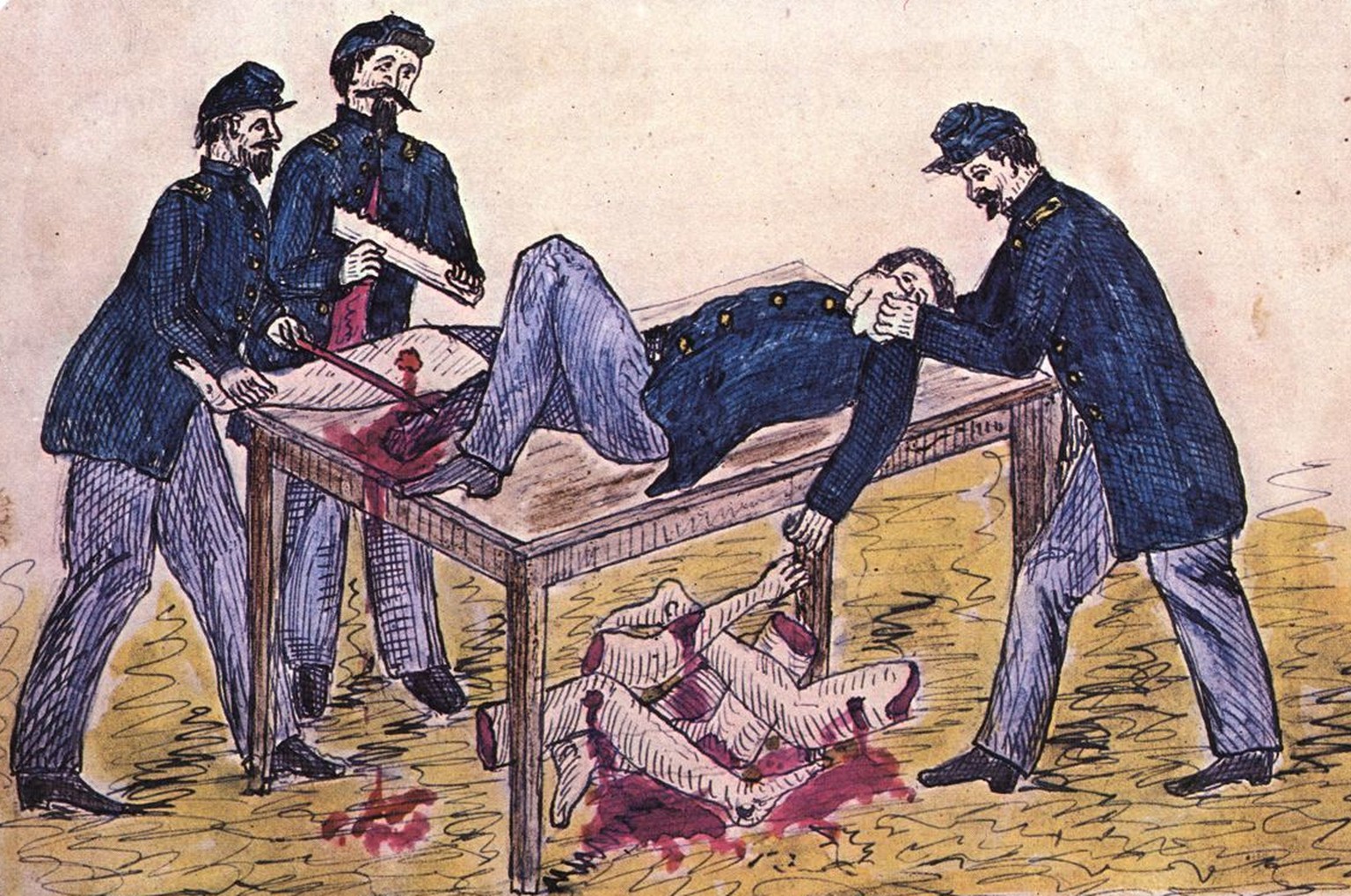 «Die Ärzte waren damit beschäftigt, Kugeln herauszupulen, Wunden abzubinden und Arme und Beine abzuschneiden, von denen ein Haufen unter dem Tisch lag.» Zeichnung aus dem Tagebuch des Soldaten Alfred  ...
