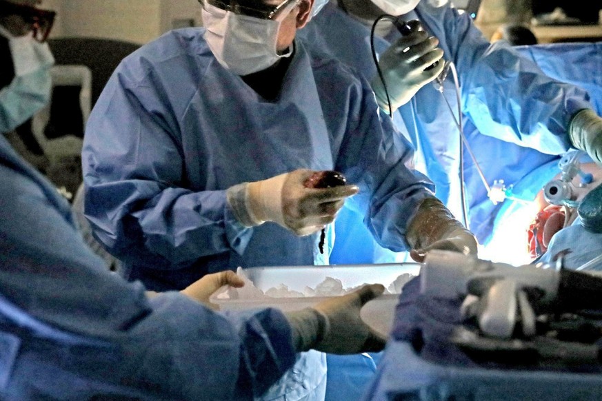FILE - In this Jan. 17, 2018, file photo, a transplant surgeon holds the kidney from a donor during surgery in St. Louis. AmericaÄôs transplant system is run by a network of government contractors th ...